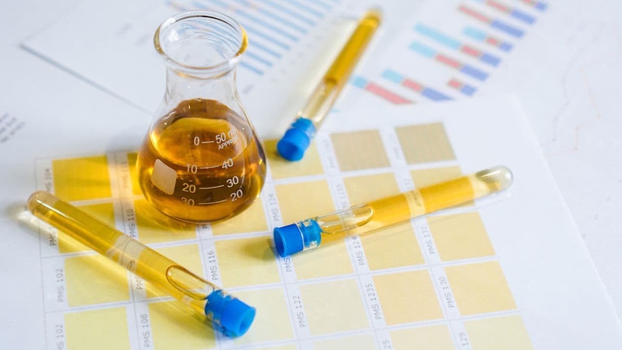imagem sobre Urinálise: como é feito e o que diagnostica