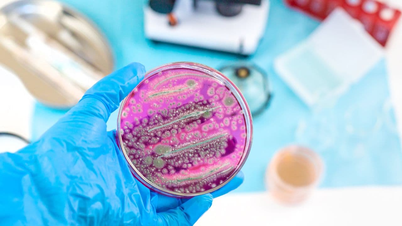imagem sobre Microbiologia: o que é, importância e aplicações?