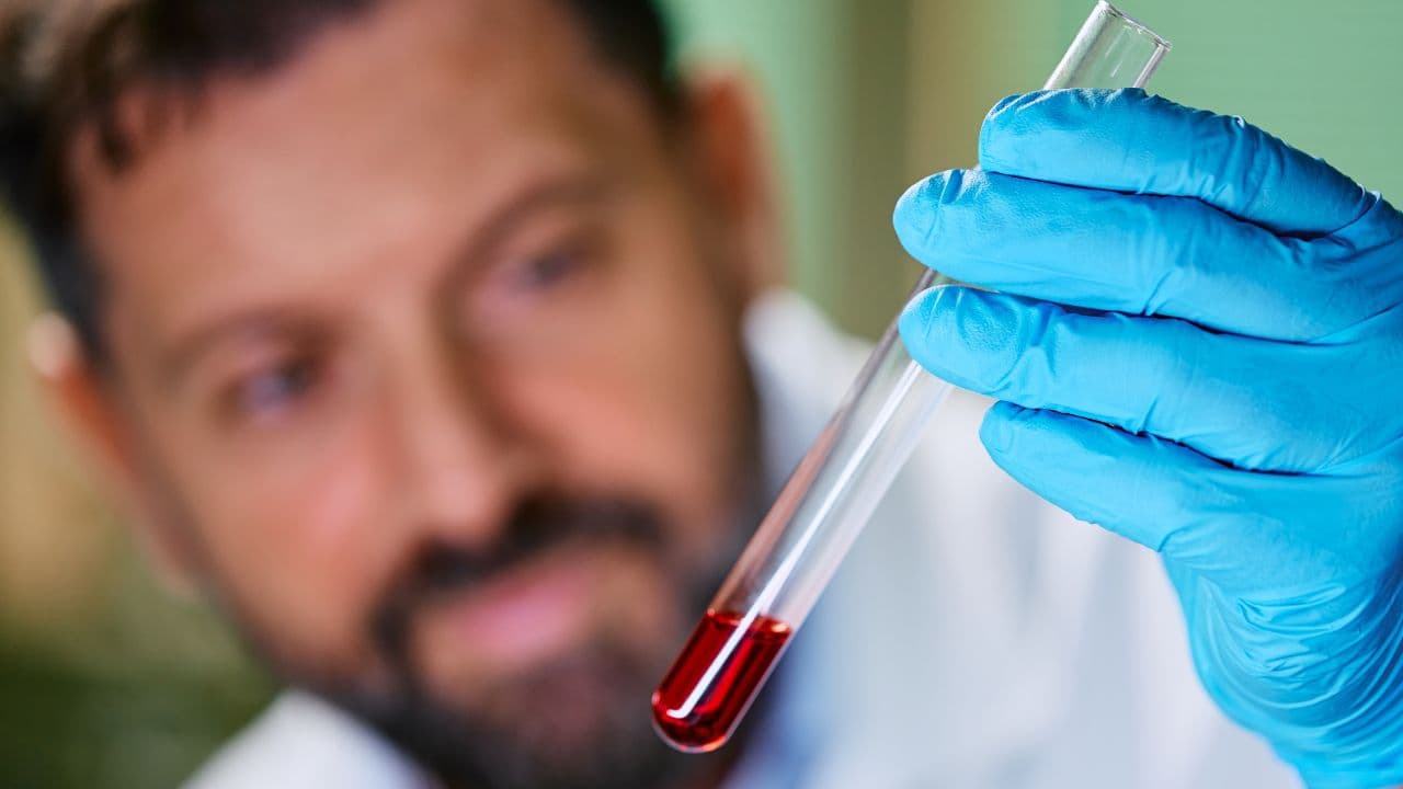imagem sobre O que é hematologia? Entenda a especialização