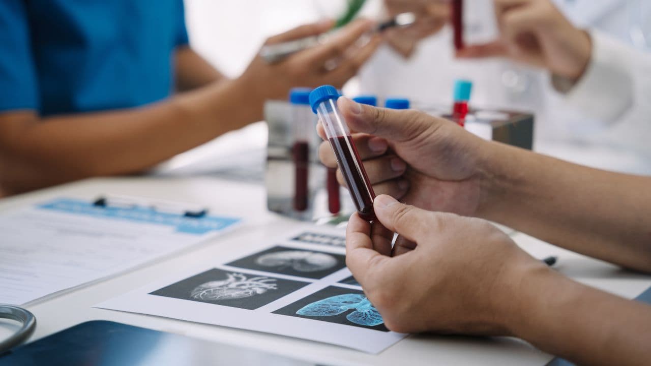 imagem sobre O que é um hematologista? Saiba mais sobre o profissional