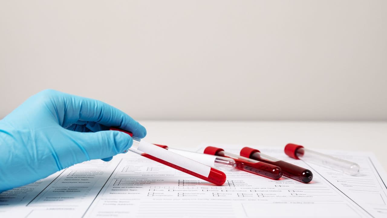 imagem sobre O que é VCM no hemograma: o que é, como é calculado e sua importância