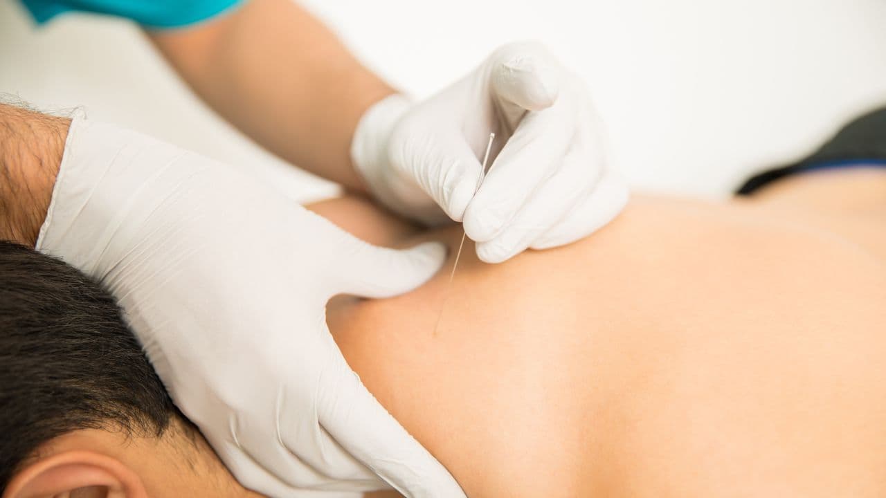 imagem sobre Para que serve acupuntura? Entenda quando ela pode ajudar e quais são seus limites