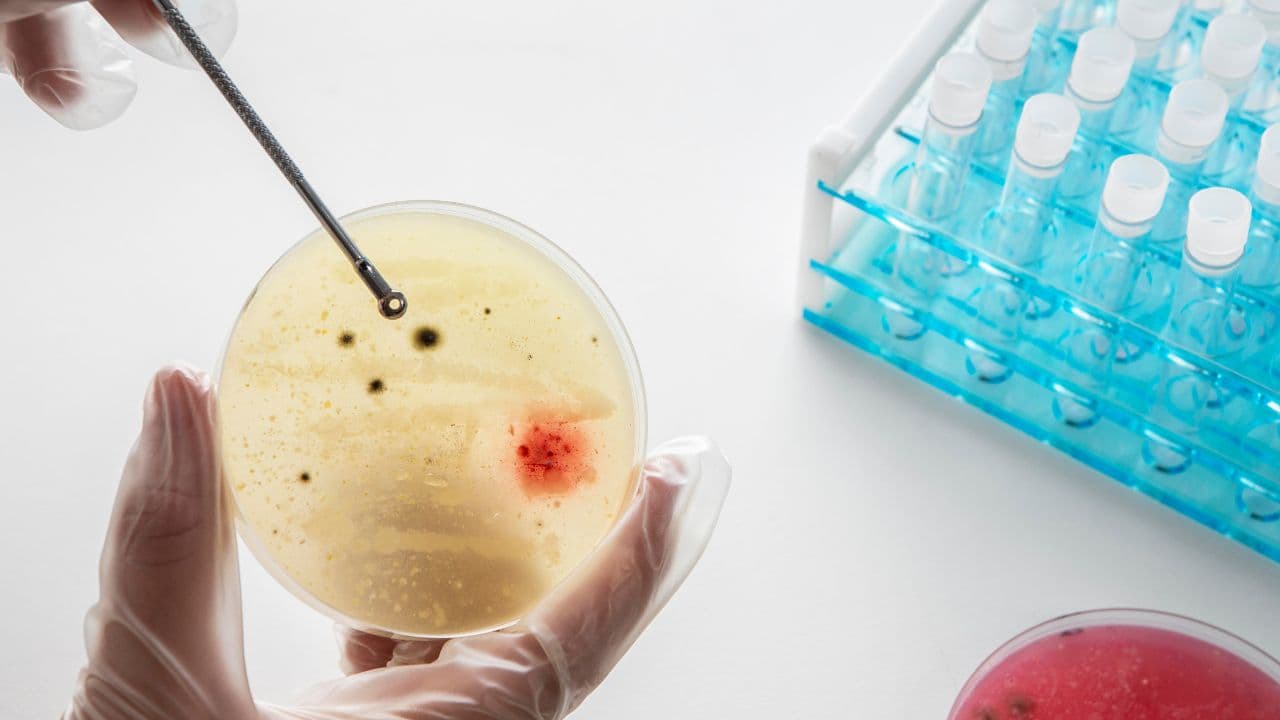 imagem sobre Parasitologia clínica: o que é, o que estuda e qual é sua importância no diagnóstico