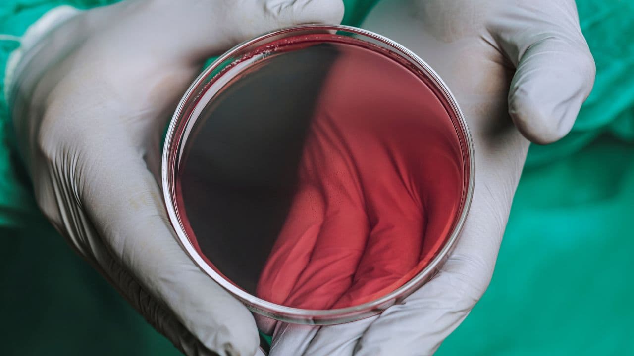 imagem sobre Parasitológico de fezes: o que é, para que serve, como coletar e como entender o exame